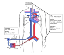 ECMO vessels